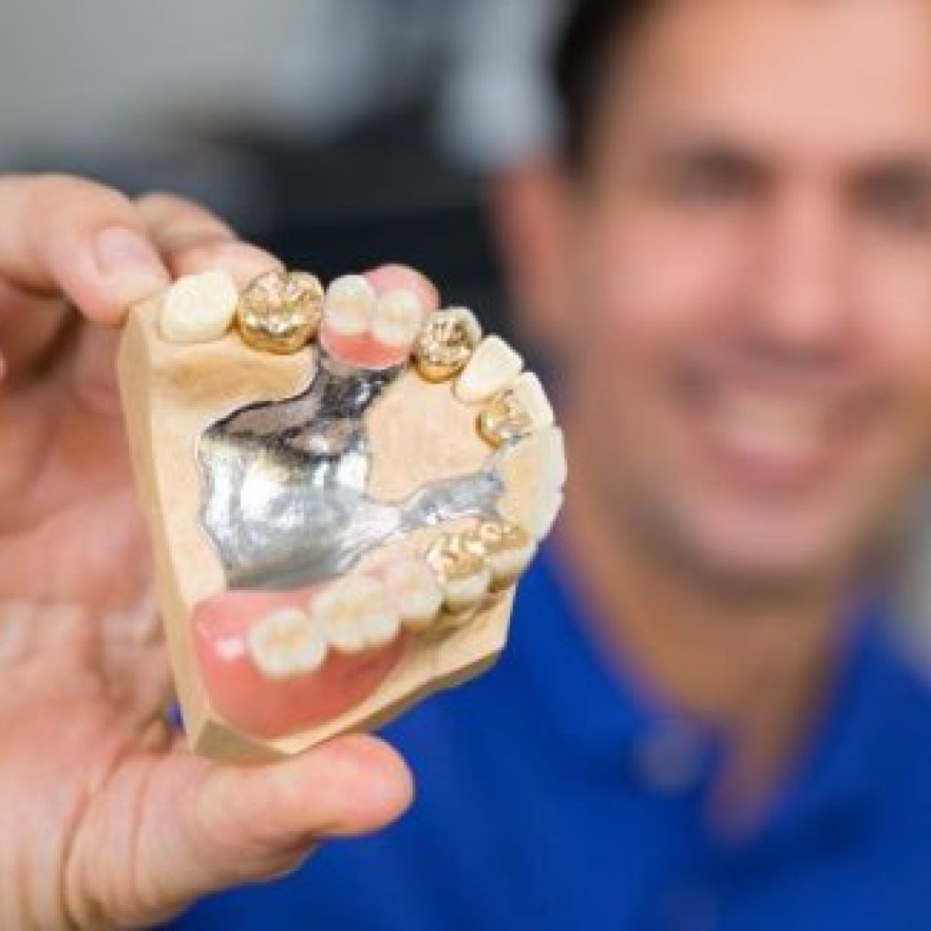 Options For Selling Dental Gold